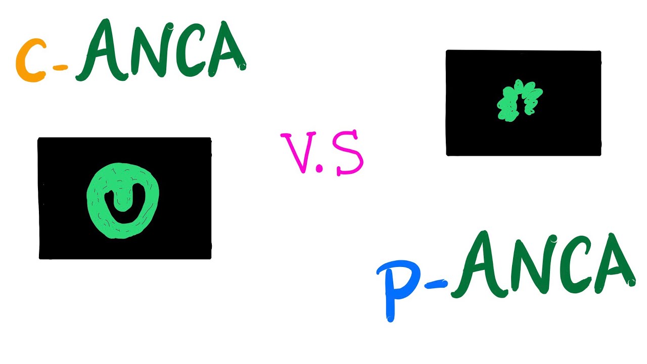 c-ANCA VS p-ANCA (Autoantibodies) | Autoimmune Diseases