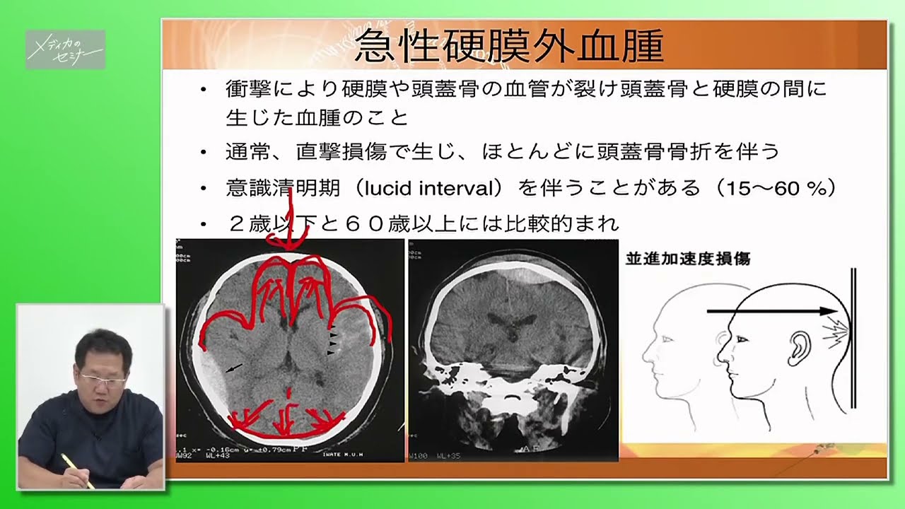 メディカのセミナー WEB講義ってなんだろう？