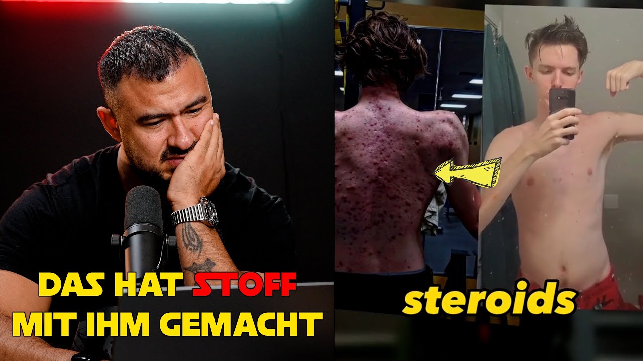 HÖR AUF!!!!