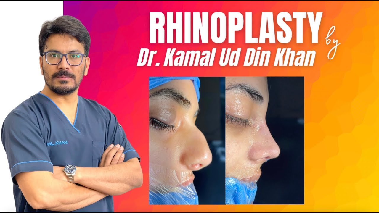 Crooked Nose Fixed | Best Rhinoplasty in Pakistan | Patient Review | Cosmetico by Dr Kamal