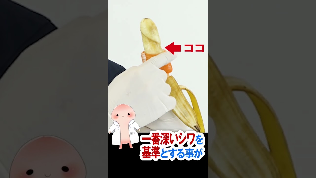 【1分間で包茎手術を解説】仮性包茎手術をバナナを使って医師が詳しく解説！！