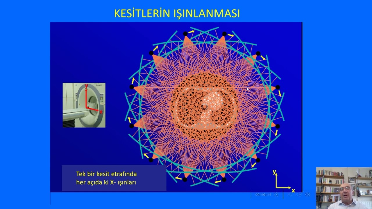 Konu 11 - 1 Bilgisayarlı Tomografinin (BT) genel prensipleri