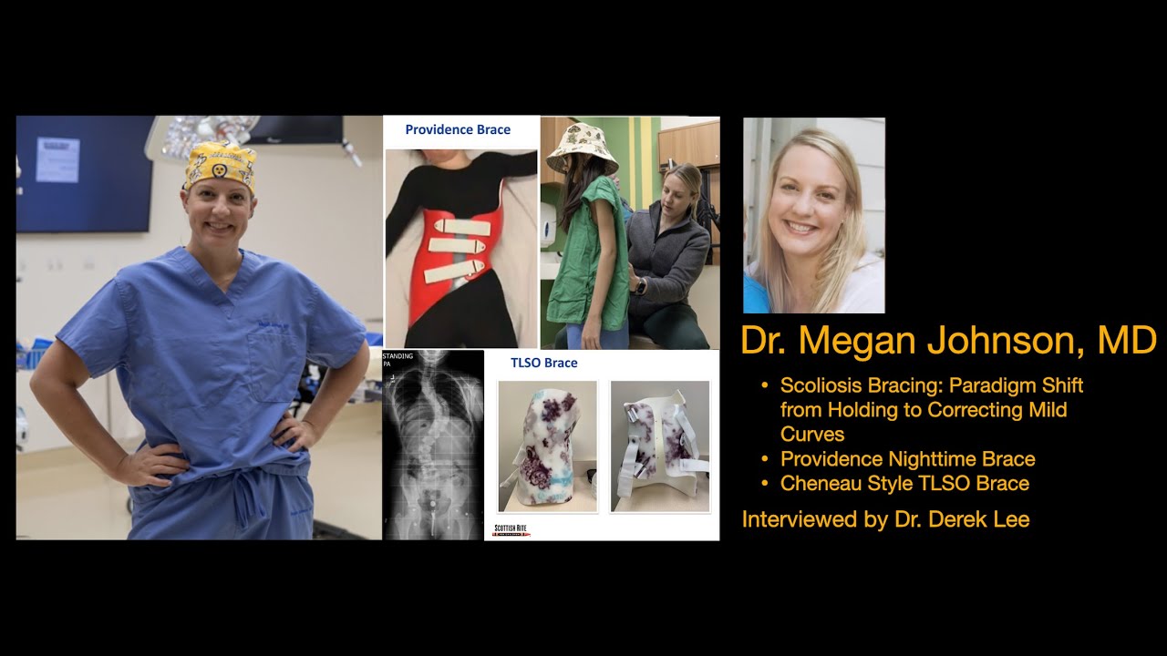 Dr. Megan Johnson, MD, on Scoliosis Bracing and Reducing Mild Curves with Dr. Derek Lee
