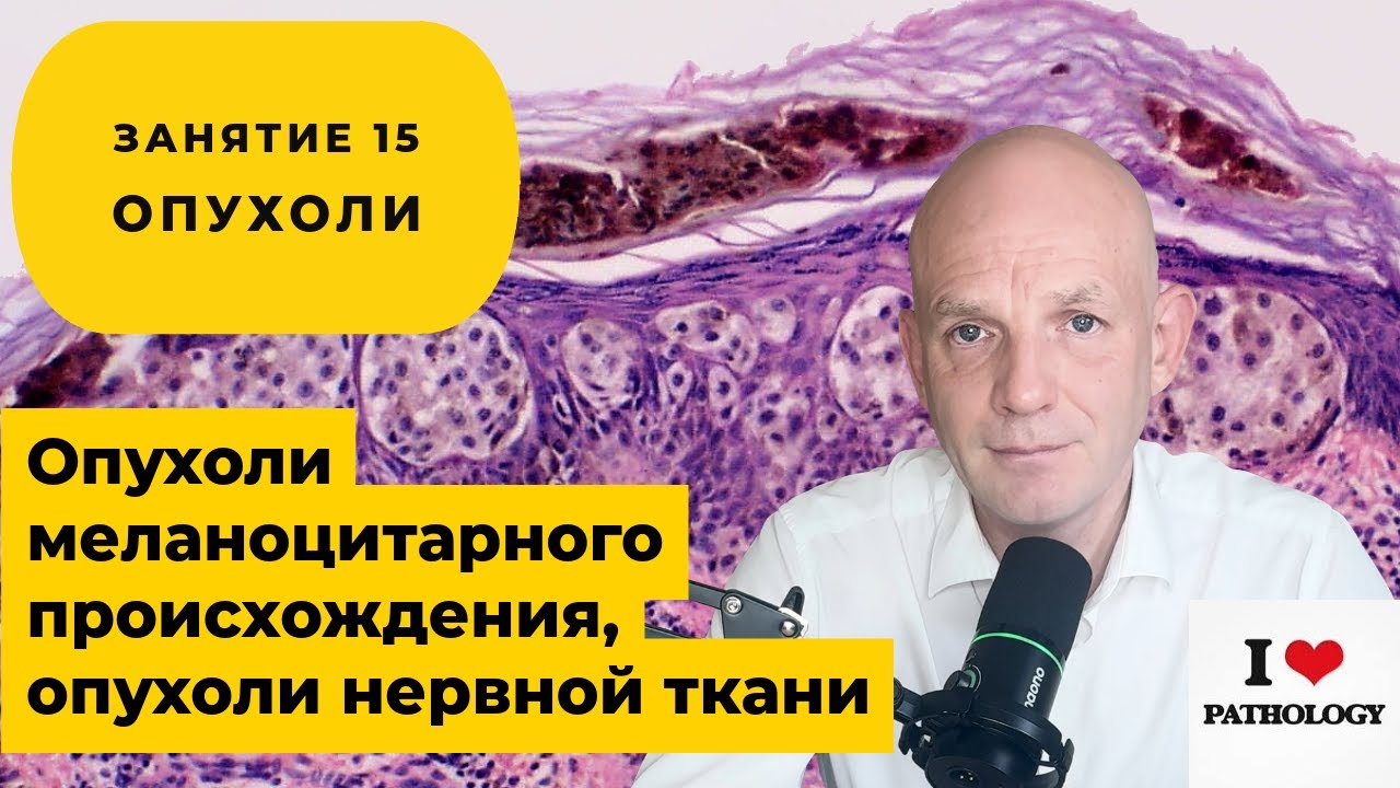 Опухоли меланоцитарного происхождения, опухоли нервной системы - краткий обзор занятия №15