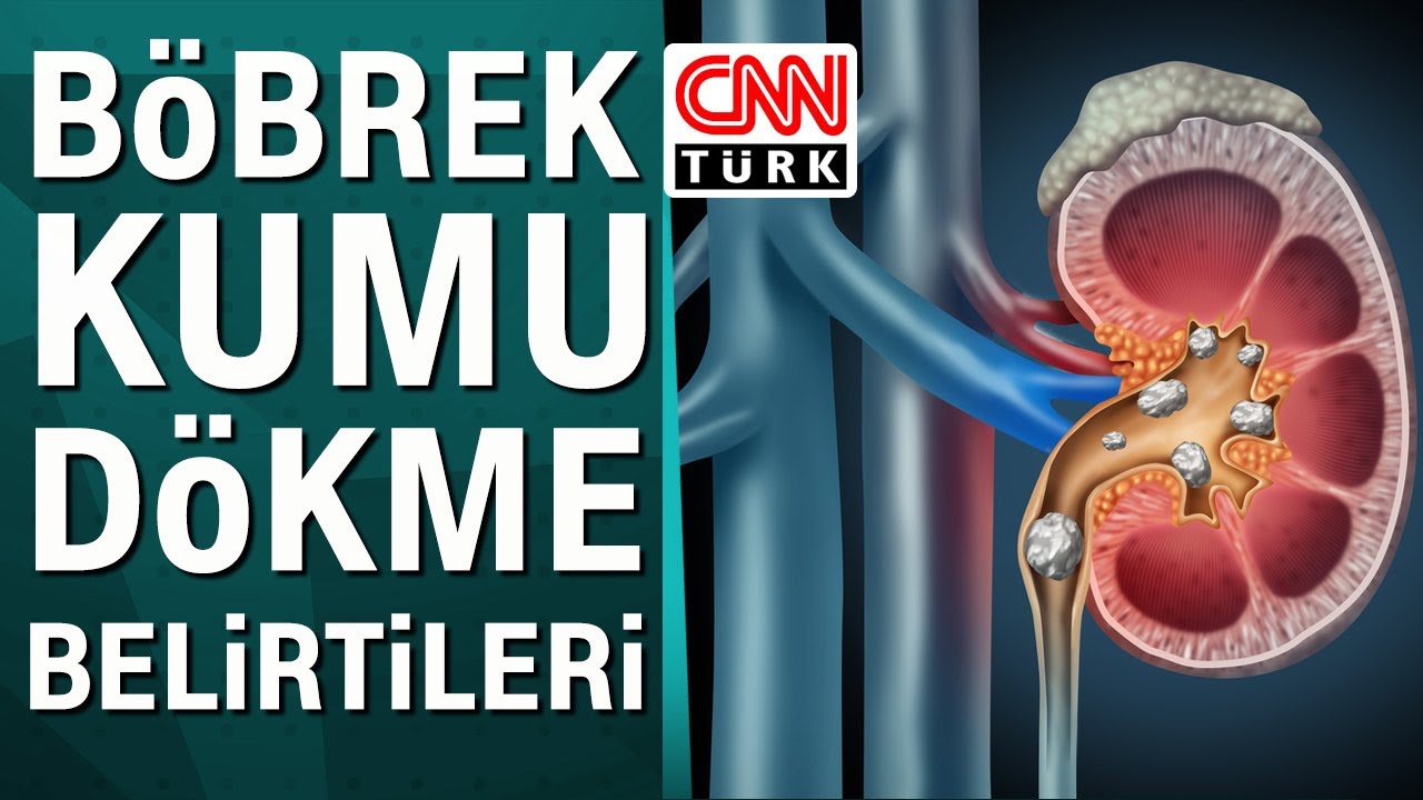B&ouml;brek kumu d&ouml;kme nedir? Belirtileri nelerdir?