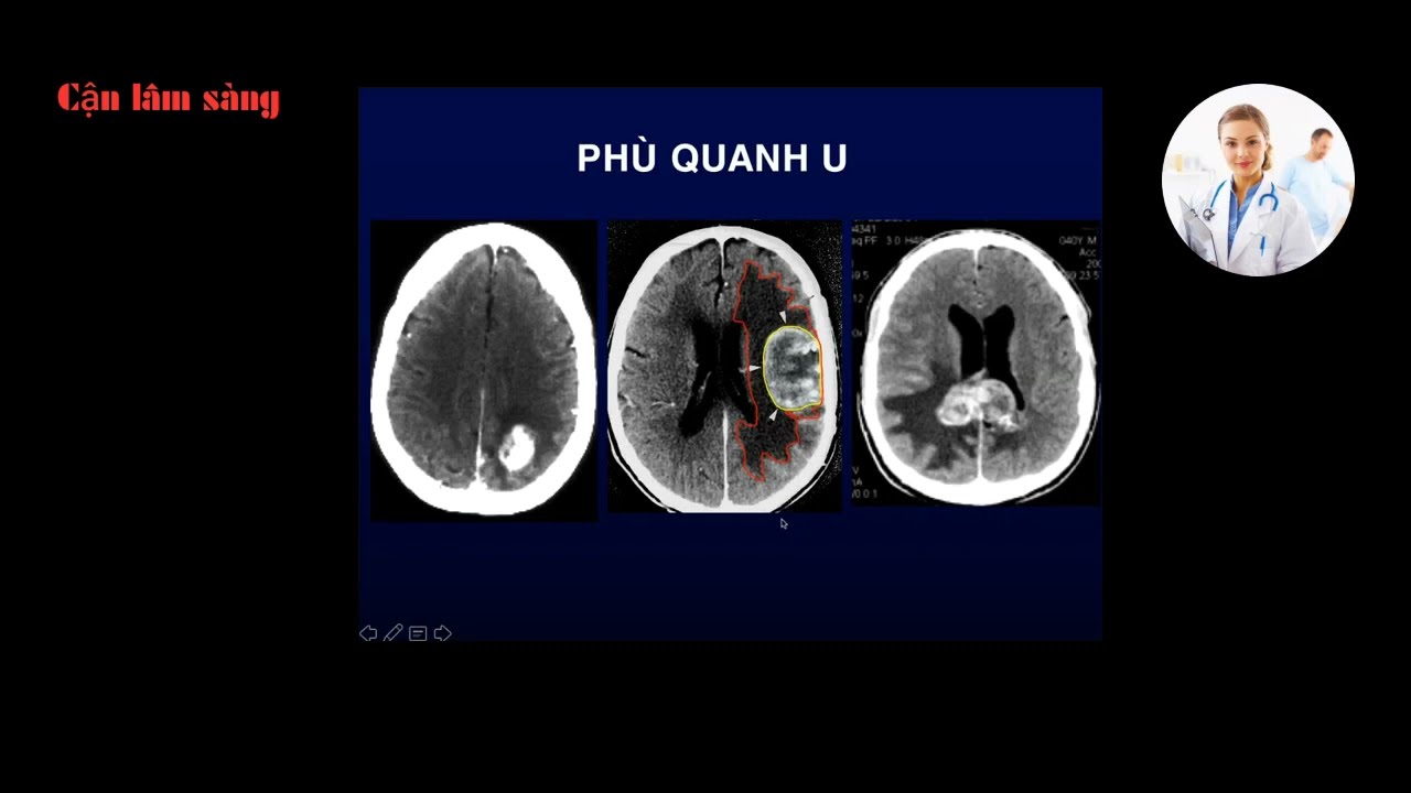 CT U NÃO | PGS. TS. Lê Văn Phước