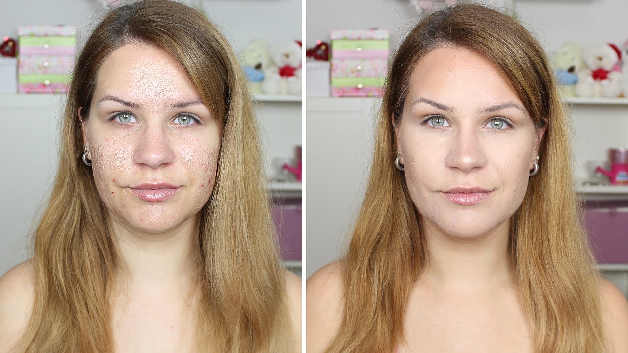 FOUNDATION ROUTINE - PICKEL & AKNE NARBEN natürlich abdecken | Lilixy Mee