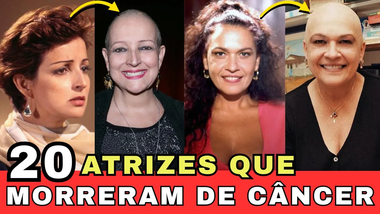 VEJA 20 ATRIZES DA GLOBO QUE MORRERAM DE CÂNCER!