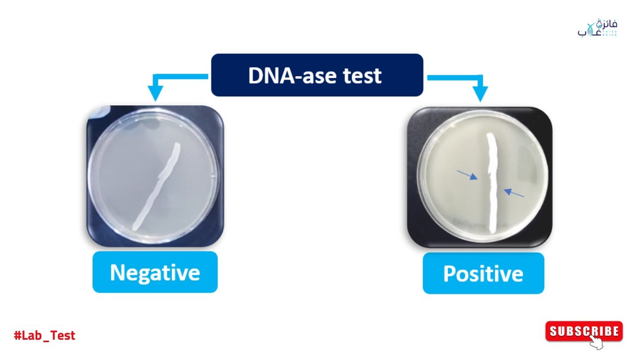 DNA-ase test