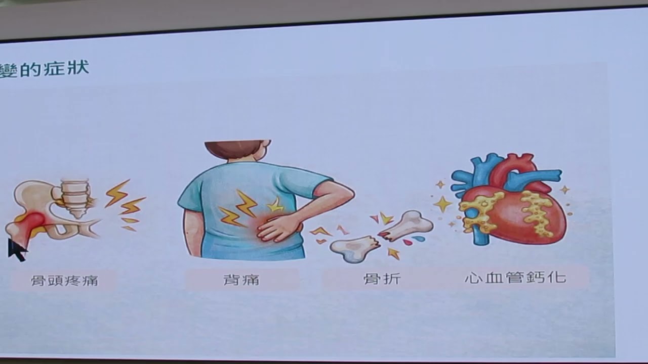 民正新聞記者:蔡永源，蔡慧茹台南報導長期高磷恐傷骨　洗腎病人慎防腎性骨病變
