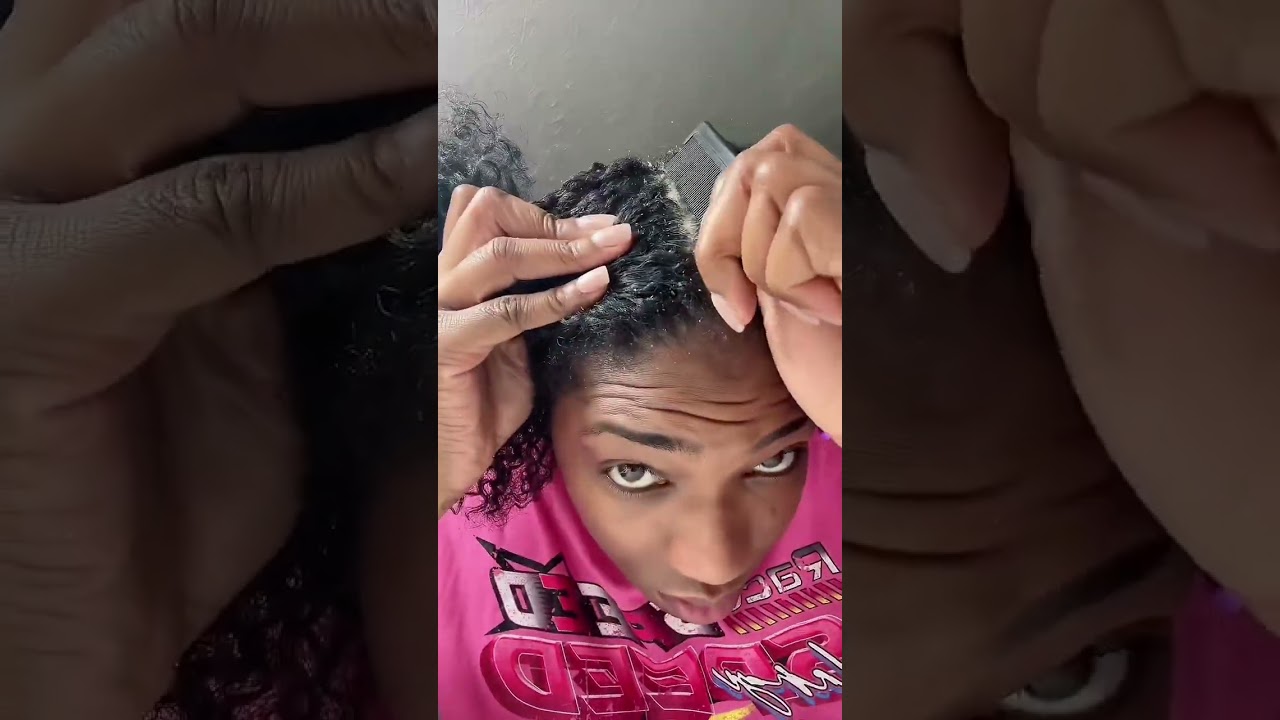 Pellicules s&egrave;ches ? Voici la solution naturelle 🍃