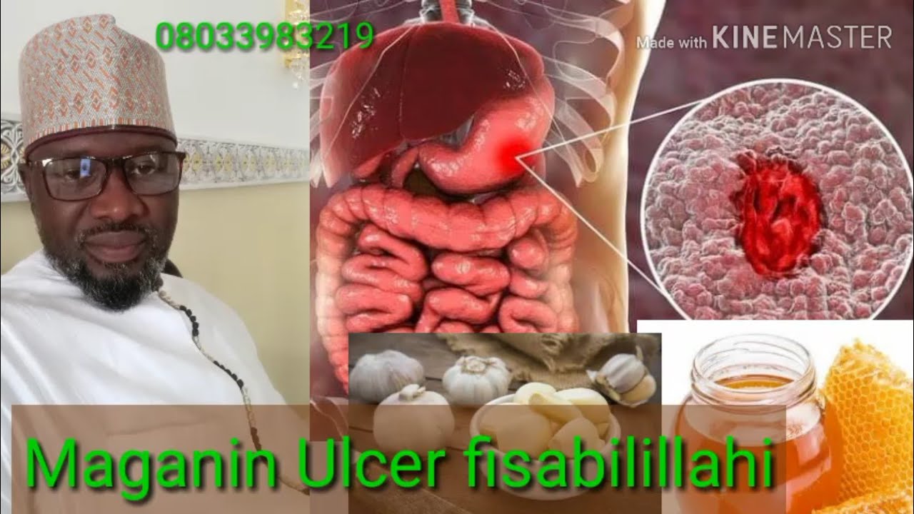 Maganin Ulcer fisabilillahi.