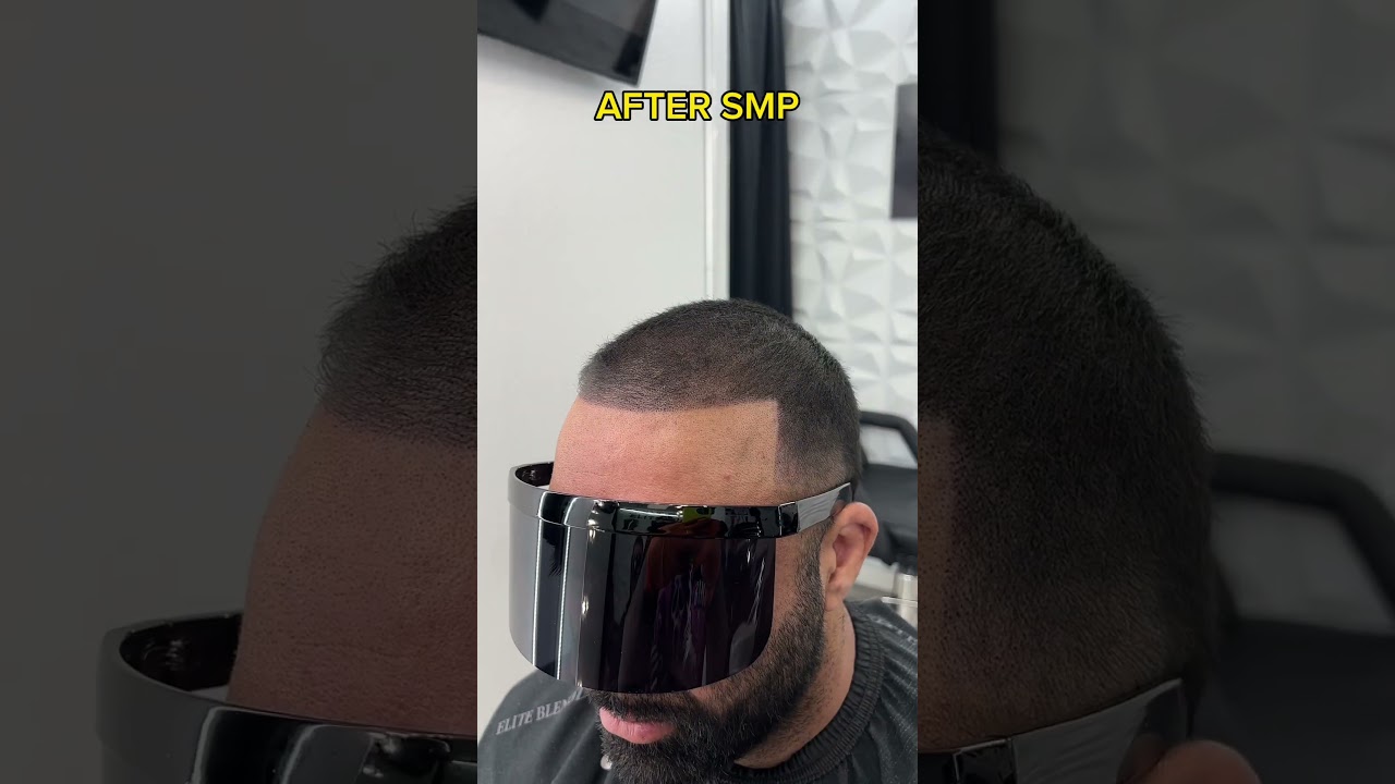 Before and After SMP