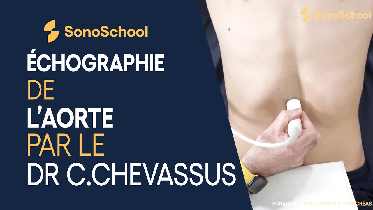 L&rsquo;examen &eacute;chographie de l&rsquo;aorte par le Dr C.Chevassus &ndash; iSonic | SonoSchool