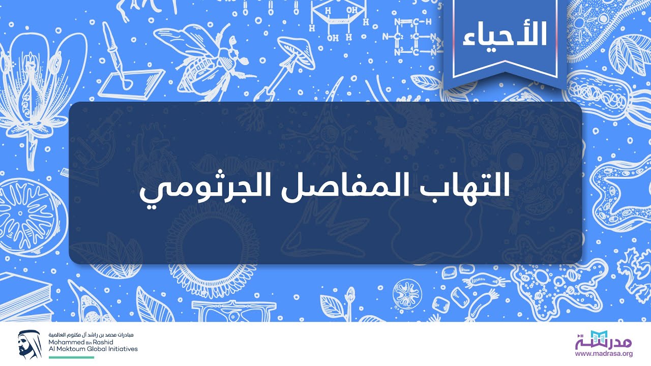 التهاب المفاصل الجرثومي | الأحياء العامة | الإضطرابات العضلية الهيكلية