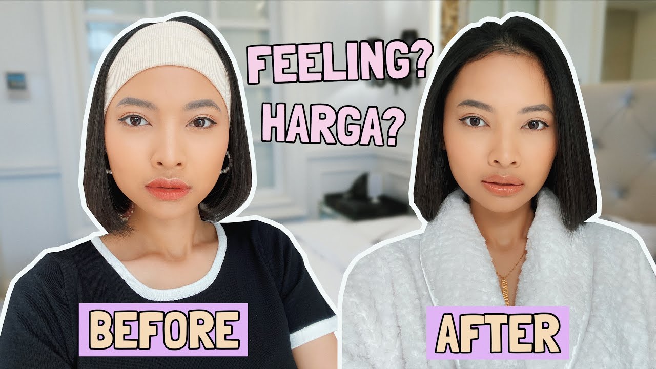 BIKIN TIRUS?! PENGALAMANKU PERTAMA KALI NYOBAIN BOTOX!
