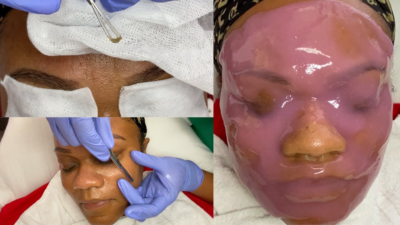 Dermaplaning + Hydration Facial Treatment | Glam By Lia Leigh