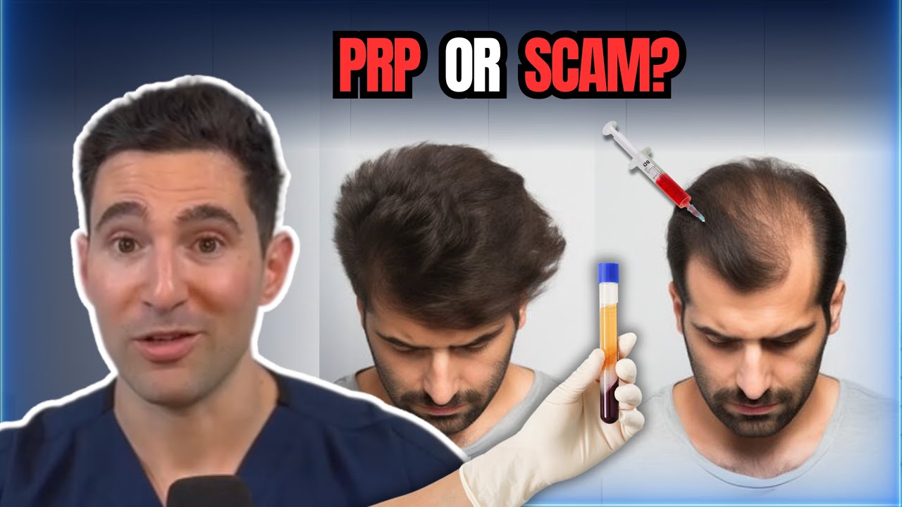 PRP FOR HAIRLOSS: SCAM OR SOLUTION? | A Doctor's Honest Take