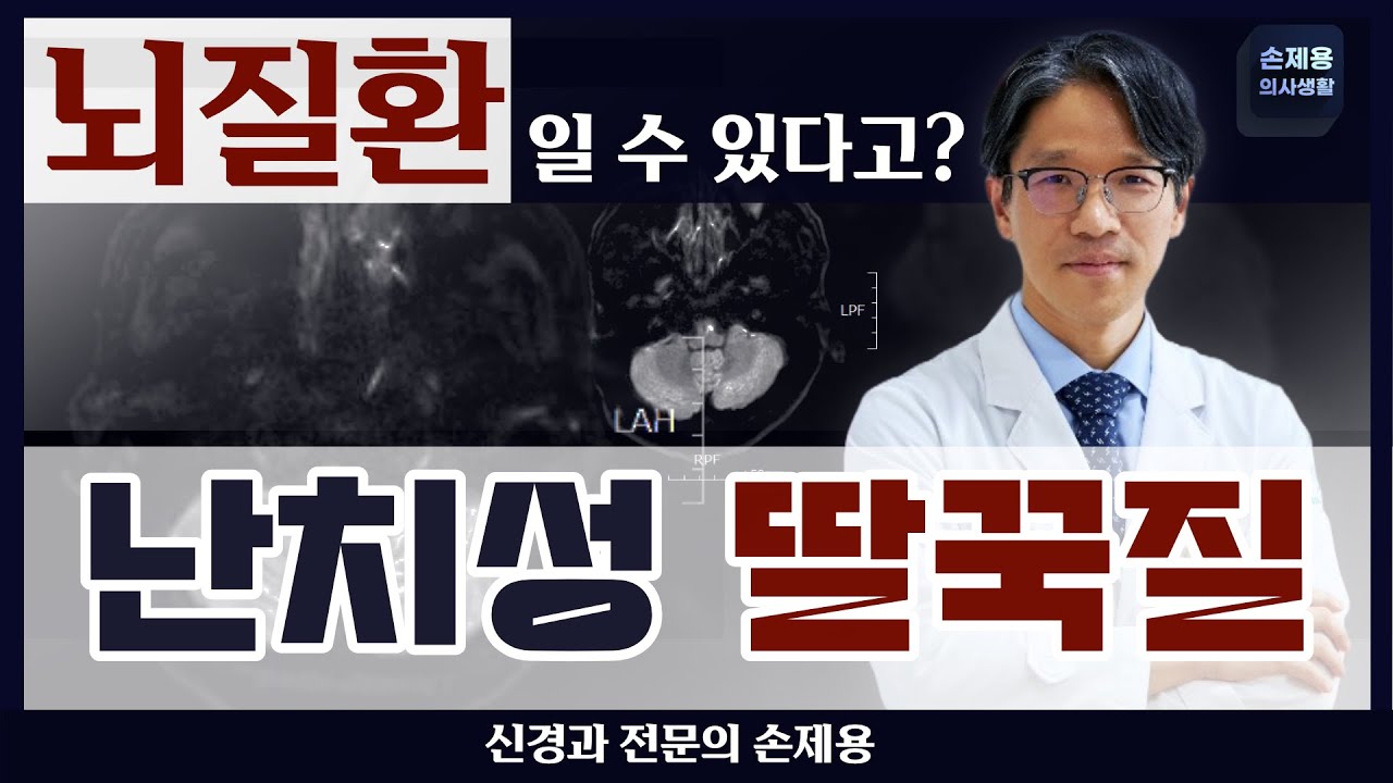 딸꾹질, 뇌질환일 수도 있다고? [난치성 딸꾹질]