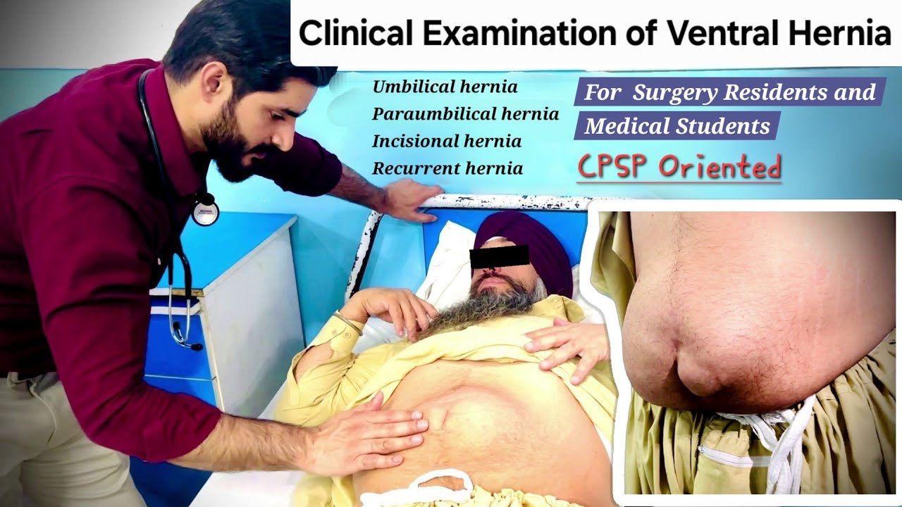Clinical Examination of Ventral Hernia - Dr Tayyab Riaz Ch