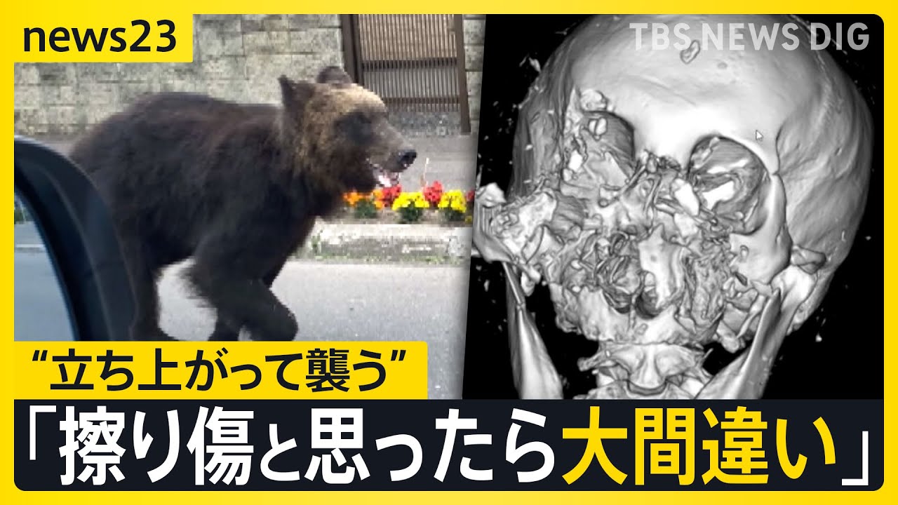 「最初の一撃で肋骨6本折れた」&nbsp;クマに襲われた男性が警鐘「獣害ではなく災害」&nbsp;深刻化する被害&hellip;老人ホームの裏に&ldquo;3時間居座り&rdquo;も【news23】｜TBS&nbsp;NEWS&nbsp;DIG
