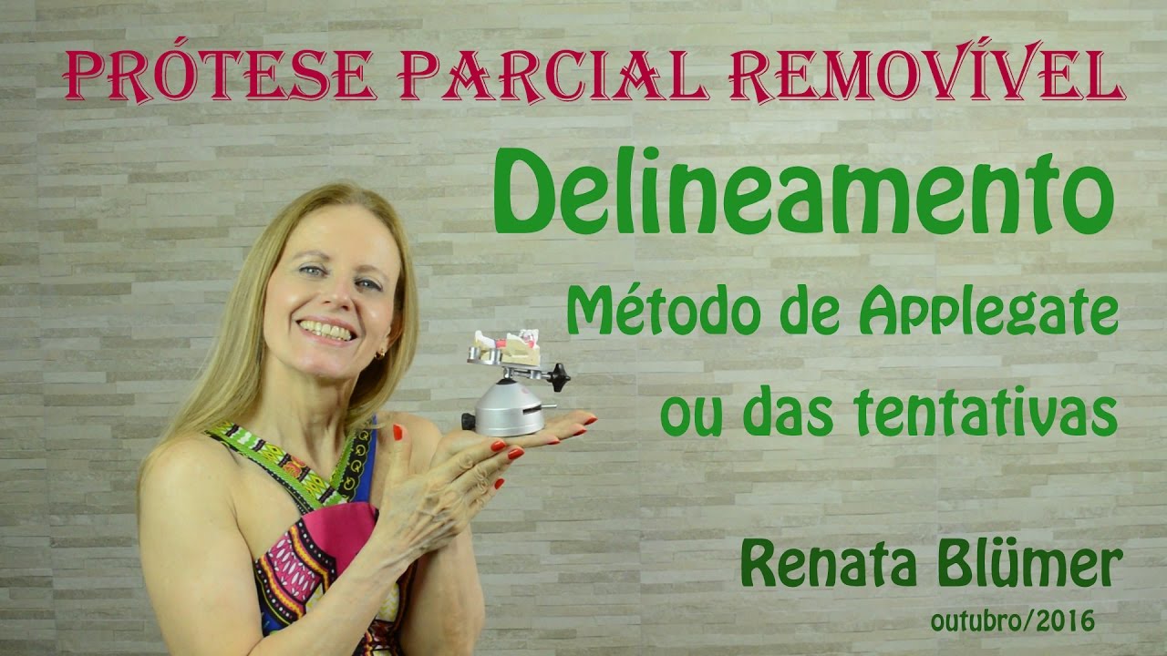 DELINEAMENTO - MÉTODO DE APPLEGATE - PRÓTESE PARCIAL REMOVÍVEL *