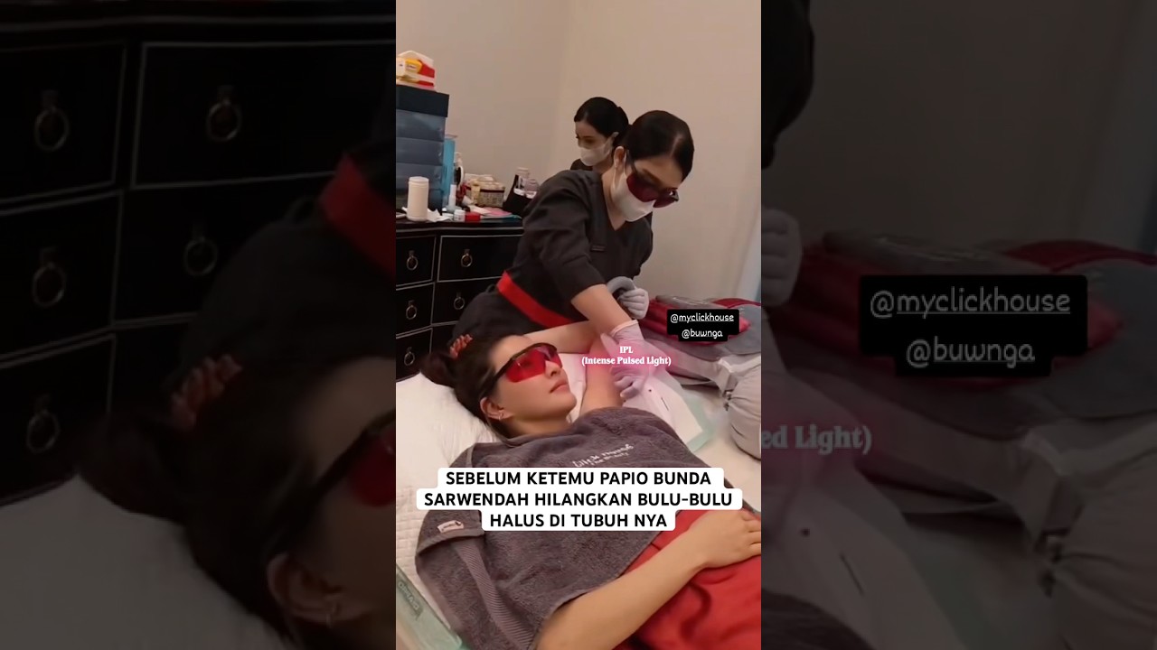 SEBELUM KETEMU PAPIO BUNDA SARWENDAH HILANGKAN BULU-BULU HALUS DI TUBUH NYA #sarwendah #sargio #onyo
