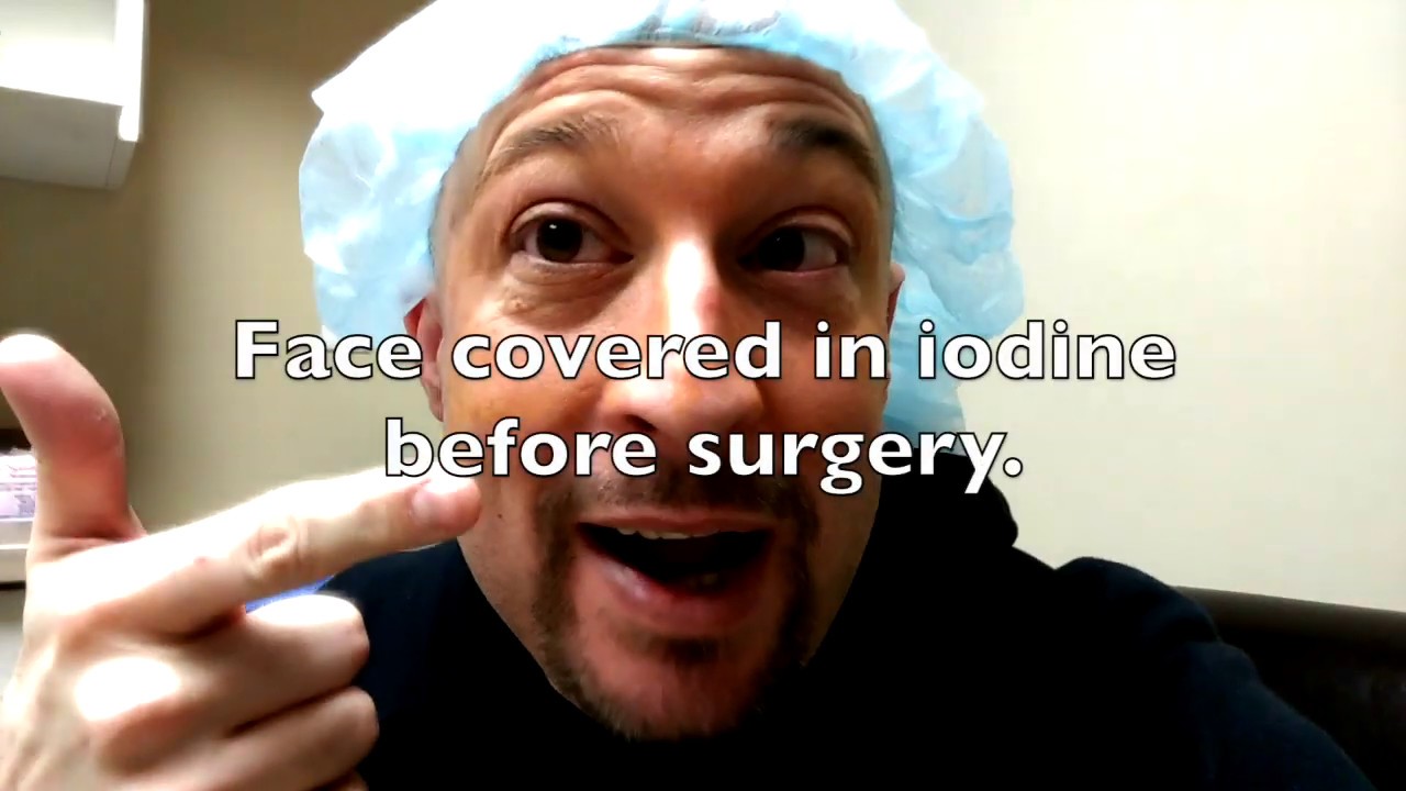 PRK Eye Surgery Recovery 2019