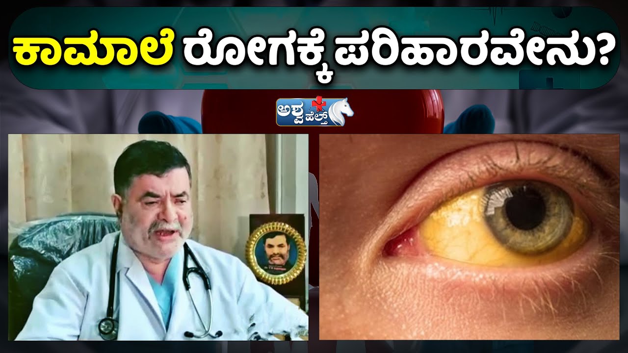 Dr.Anjanappa Explains About Jaundice | ಕಾಮಾಲೆ ರೋಗಕ್ಕೆ ಪರಿಹಾರವೇನು..? | @AshwaHealth​