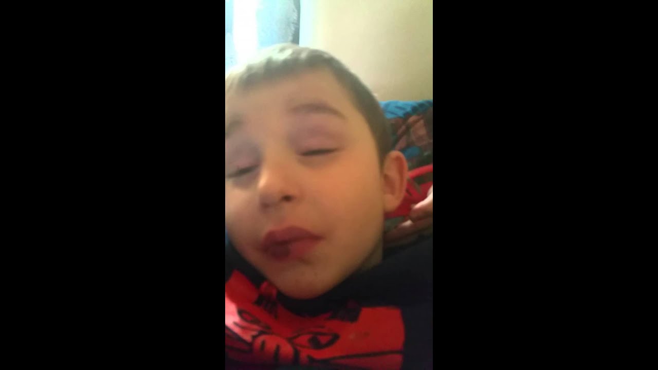 Jacobs seizures...
