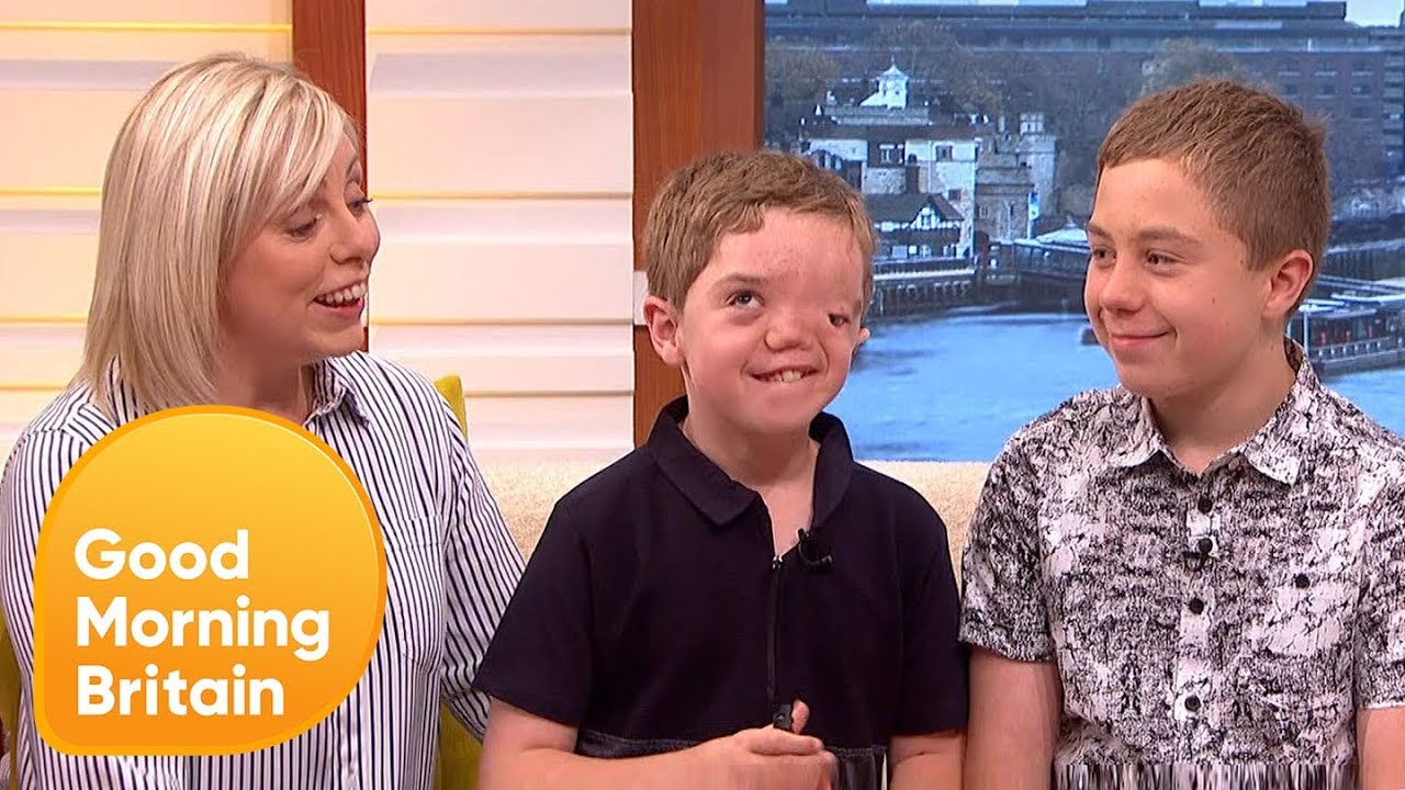Instagram Has Apologised For Removing Photo Of Boy With Facial Disfigurement | Good Morning Britain