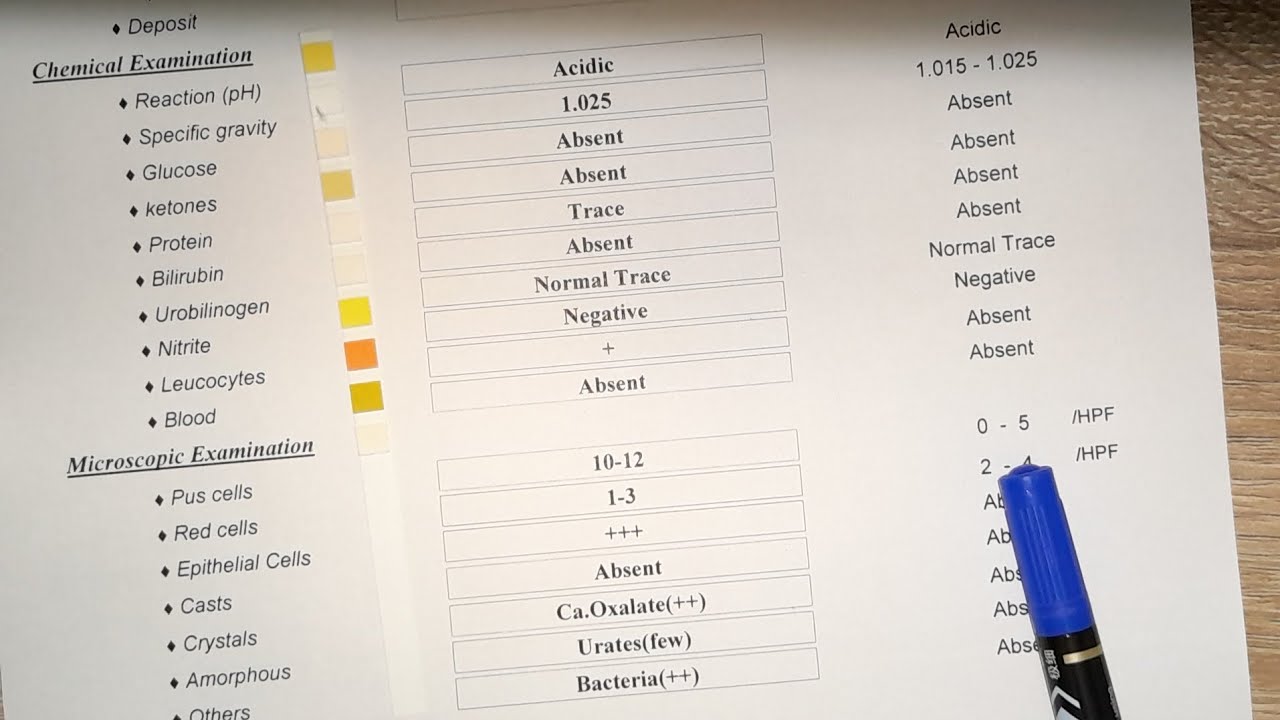 كيفية قراءة تحليل البول(Urine analysis)