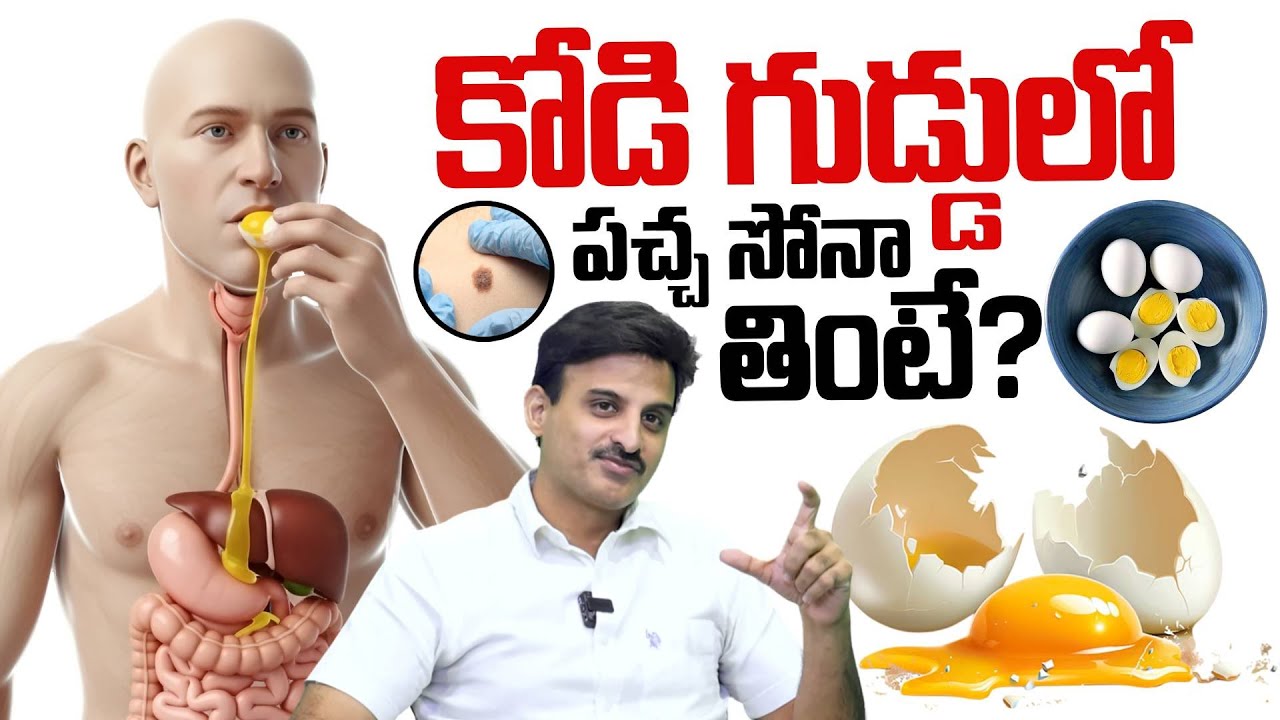 కోడి గుడ్డులో ఉండే పచ్చ సోనా తింటే? Dr. Ravi Kanth Kongara About Egg White Health Benifits | SumanTV