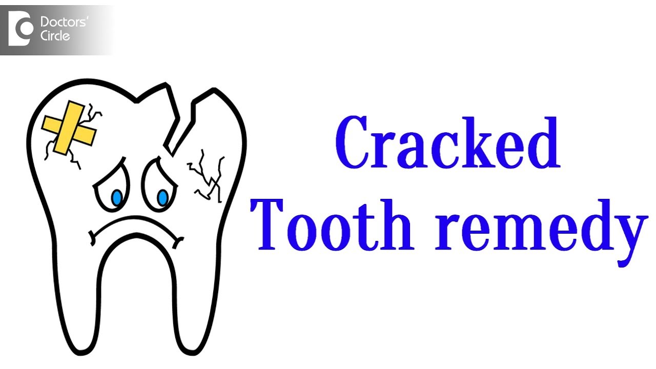 Cracked tooth treatment
