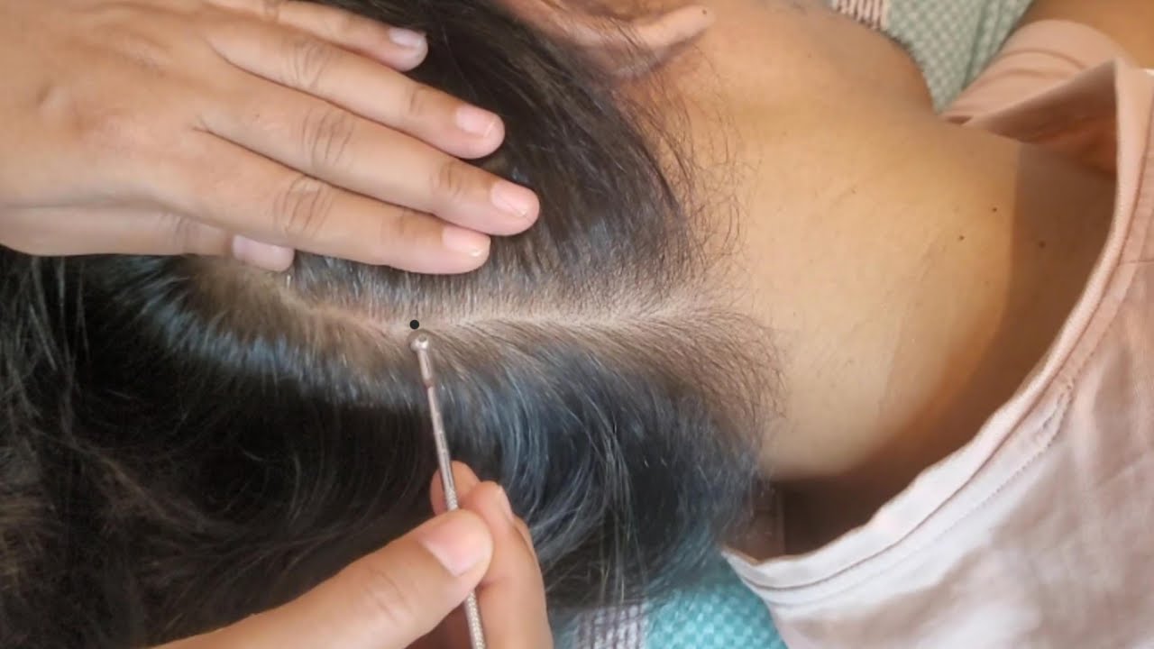 ASMR Scalp Check: The Most Relaxing Experience Ever(Real Person)✨