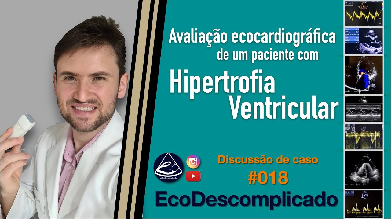EcoDescomplicado - Discussão de caso AO VIVO #018 - Avaliação da Hipertrofia Ventricular pelo ECO