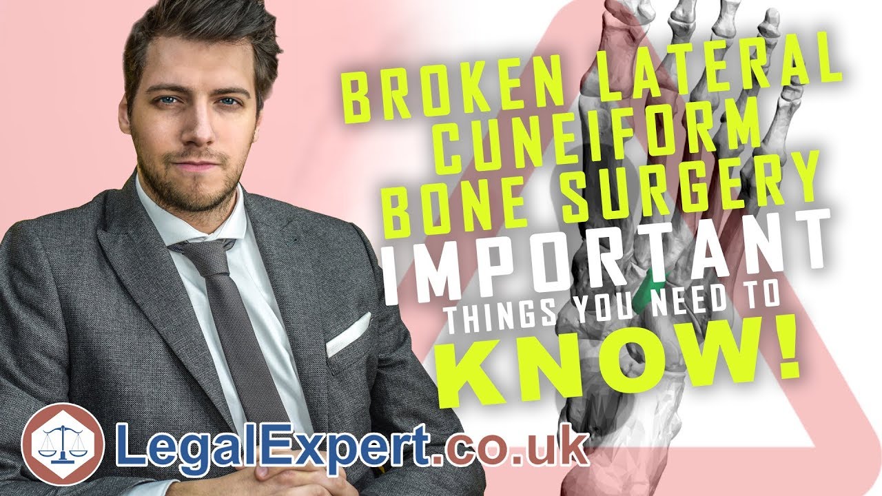 Broken Lateral Cuneiform Bone Surgery ( 2020 ) UK