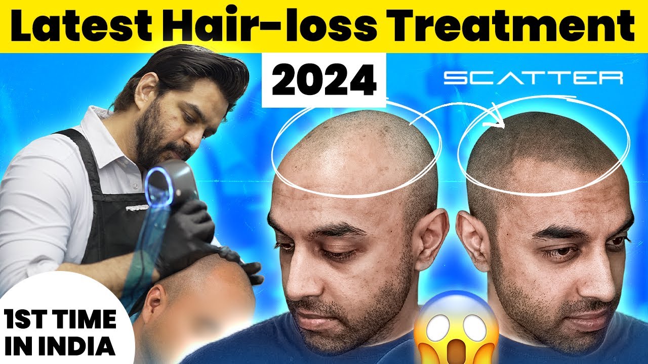 Discover the Revolutionary Robotic SMP Solution: First Ever Treatment in India!