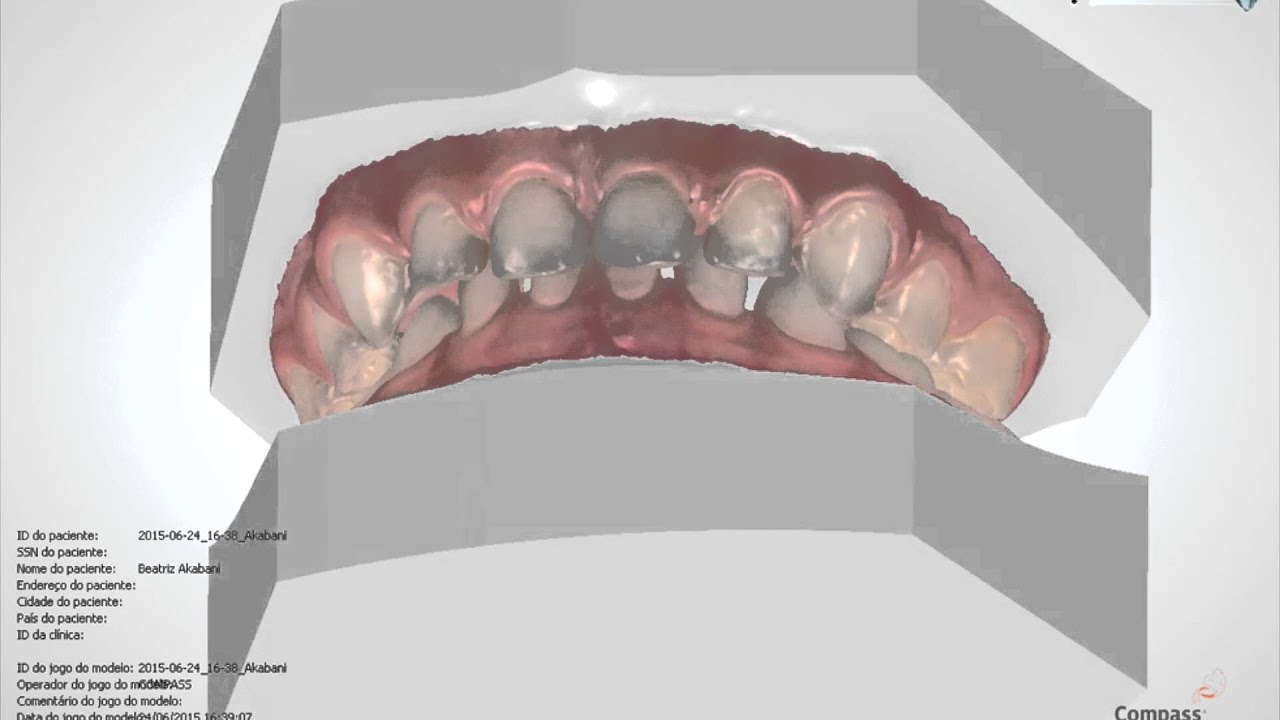 Pistas Diretas Modificadas