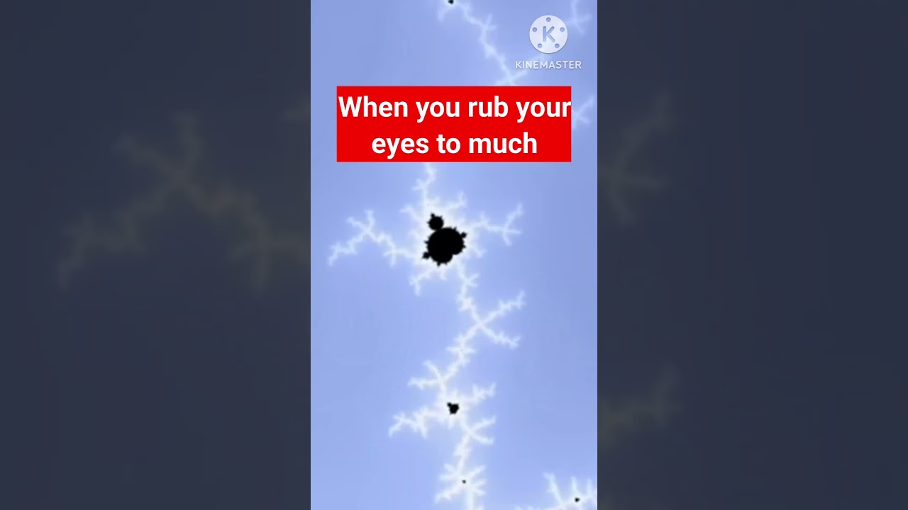 Eyes #shorts #viral #relatable #ohiotv