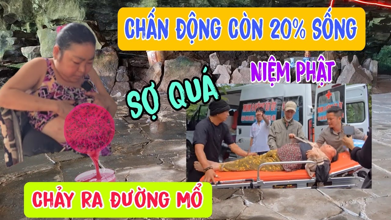 Chuyện lạ 👉Sợ Quá Chảy Ra Đường Mổ Còn 20% Sống | Châu Phú Hảo Hòa