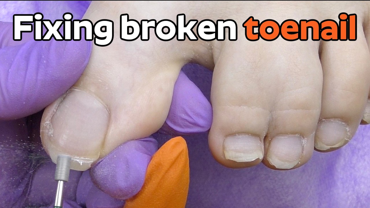 How to Fix a Broken Toenail - Gel Pedicure Tutorial on Webbed Toes *Satisfying*