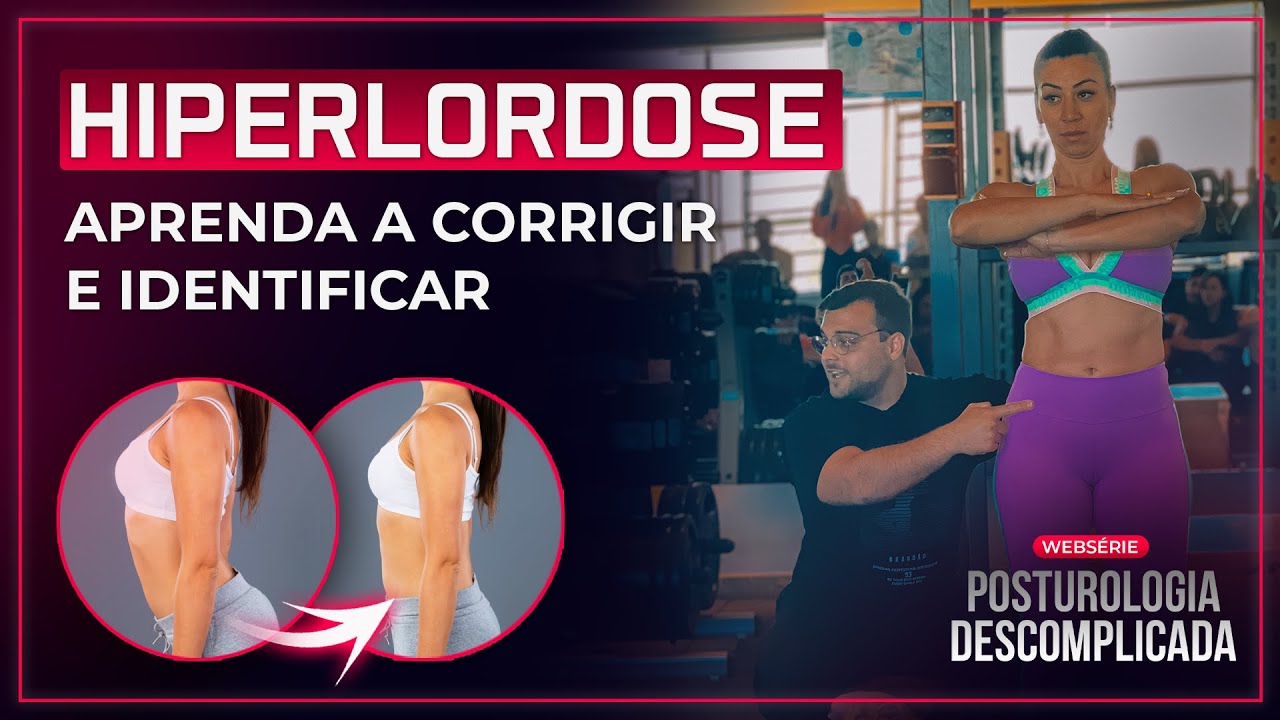 HIPERLORDOSE: Como Corrigir e Identificar esse Desvio Postural? I Posturologia - #Live1