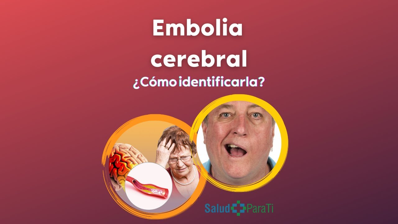 &iquest;QU&Eacute; ES UNA EMBOLIA CEREBRAL?