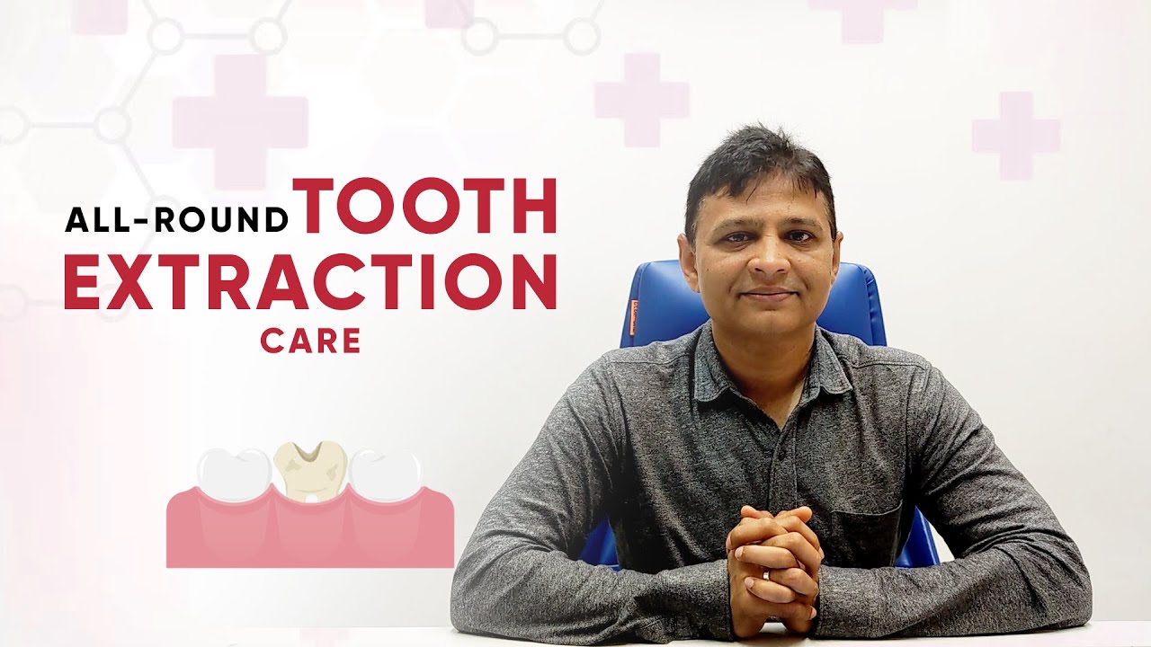 Tooth Extraction (Post Operative Instructions-Care | Dr. Anand Jasani | City Dental Hospital