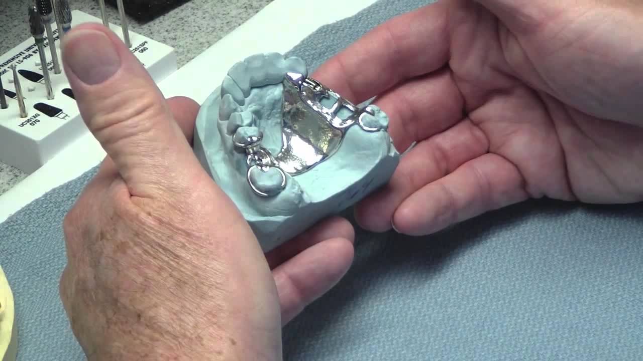 Partial Denture - Cast vs Flexible