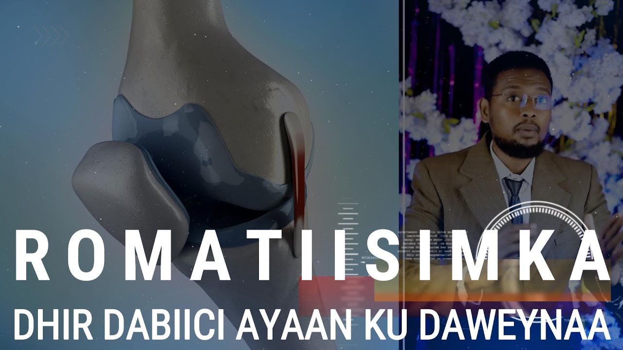ROMATIISIMKA  DHIR DABIICI AYAAN KU DAWEYNAA