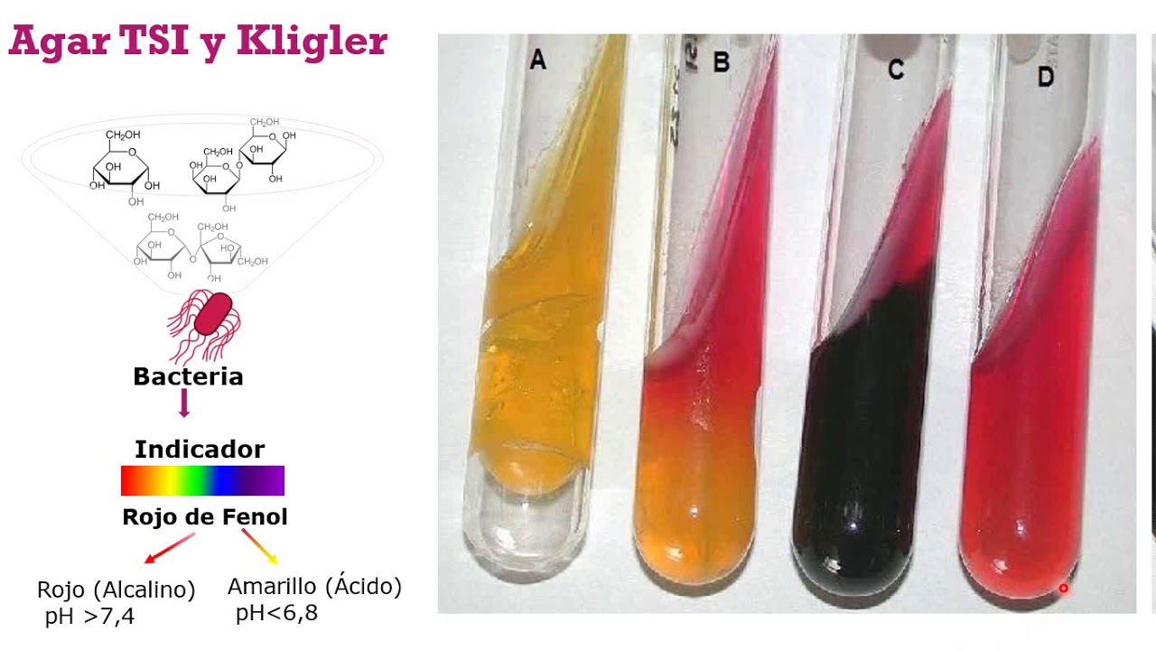 Pruebas Bioquímicas IV