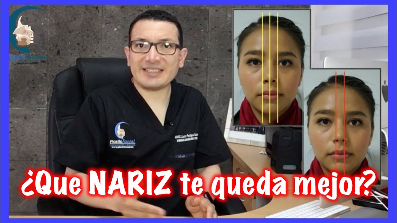 ANÁLISIS FACIAL para RINOPLASTÍA - PlasticFacial MX