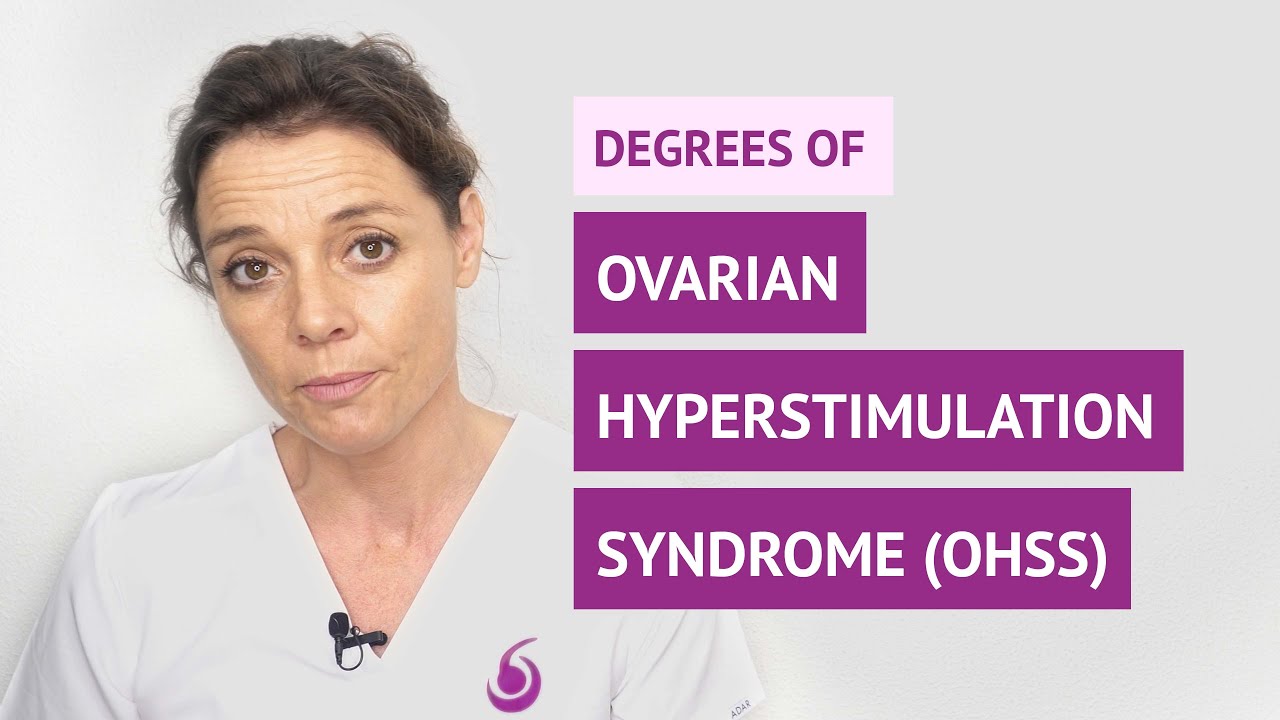 What are the different degrees of ovarian hyperstimulation syndrome (OHSS)?